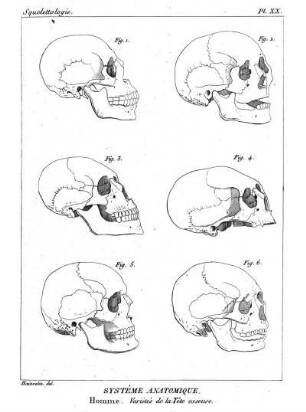 Pl. XX. Systême Anatomique. Homme. Variétés de la Tête osseuse.