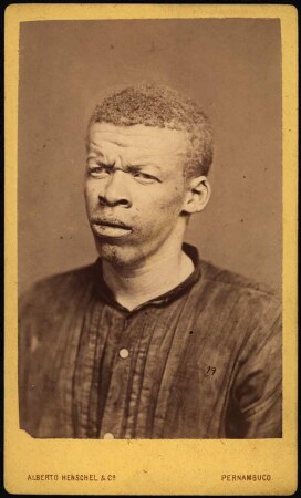 Afrobrasilianer (Albino)