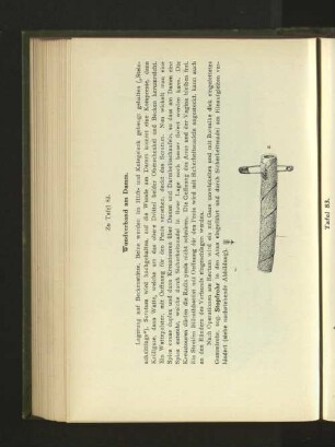Tafel 83.