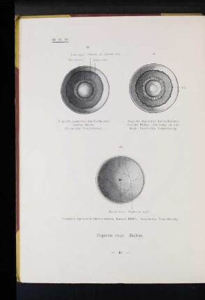 98 Augapfel, äquatorial durchschnitten, hintere Hälfte. Zweimalige Vergrößerung.