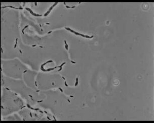 Stigmatella aurantiaca (Myxobacteriales) - Schwarmentwicklung und Morphogenese