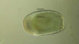 Anthozoa planula larva Helgoland 2011