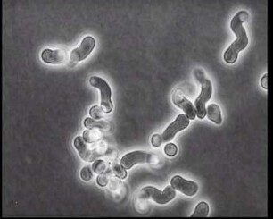 Aspergillaceae - Asexuelle Vermehrung bei Aspergillus fumigatus