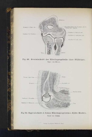 Fig. 49. Frontalschnitt des Ellenbogengelenks. Fig. 50. Sagittalschnitt d. linken Ellenbogengelenks e. 8jähr. Knaben.