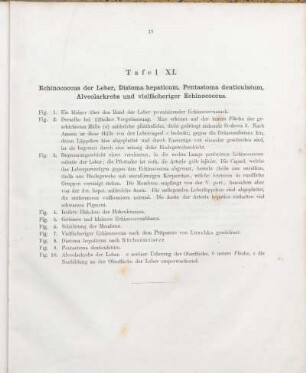 Tafel XI. Echinococcus der Leber, Distoma hepaticum, Pentastoma denticulatum, Alveolarkrebs und vielfächeriger Echinococcus.