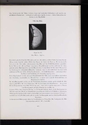 VII. Die Milz