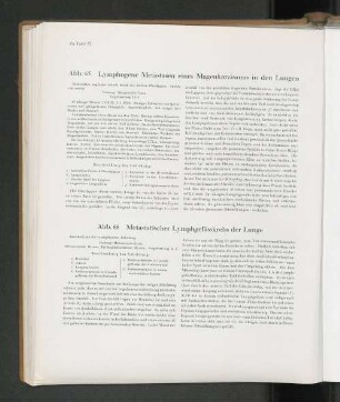 Abb. 66 Metastatischer Lymphgefässkrebs der Lunge
