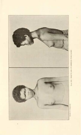 Plate XXII. Negrito girl of Zambales (Pure blood)