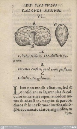 DE CALCULIS CALCULI RENUM. VII.