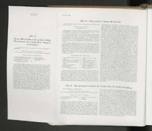 Abb. 56 Konglomerattuberkel bei chronischer Lungentuberkulose