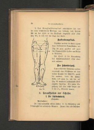 B. Krankheiten der Scheide.