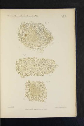 Jahrbücher d. Hamburg. Staatskrankenanstalten. VI. 2. Tafel I.