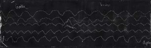 [Graphical recordings: respiration]