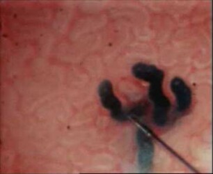 Tubuläre Resorption an der Nierenoberfläche der Ratte (Split drop)