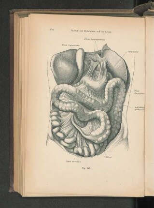 Fig. 342. Varietät des Dickdarms und der Leber.