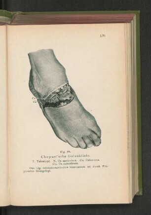 Fig. 59. Chopart'sche Gelenklinie.