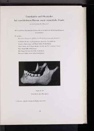 Unterkiefer und Oberkiefer bei verschiedenen Rassen, sowie vorzeitliche Funde (Aus der Sammlung Prof. Klaatsch)