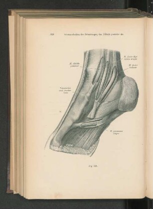Fig. 629. Sehnenscheiden der Zehenbeuger, des Tibialis posterior und des M. peronaeus longus.