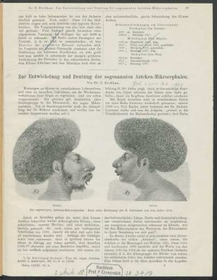 Zur Entwicklung und Deutung der sogenannten Azteken-Mikrocephalen.