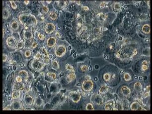 Macrophages - HIV-induced Syncytia Formation in Human Monocytes/Macrophages