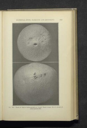 Fig. 161. - Black pit form of citro-necrosis...