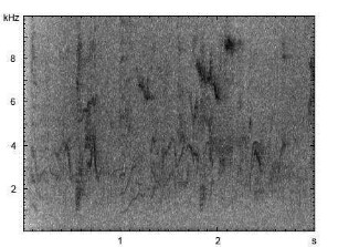 Star | Sturnus vulgaris - Gesang