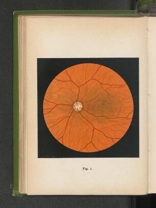 Fig. 1. Normaler Augengrund.