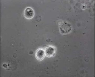 Leukozyten (Homo sapiens) - Morphologische Veränderungen unter Einwirkung von Hämolysin aus Pseudomonas aeruginosa in vitro