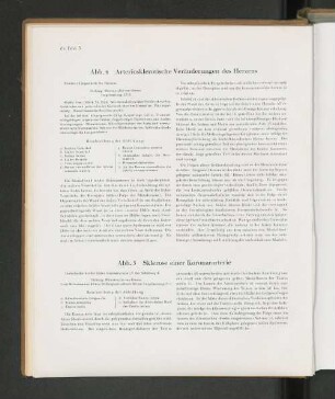 Abb. 4 Arteriosklerotische Veränderungen des Herzens