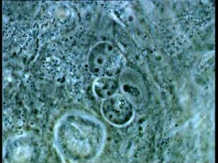 Entwicklungszyklus von Eimeria tenella