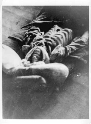 Verhungerter KZ-Häftling (Dachau?)