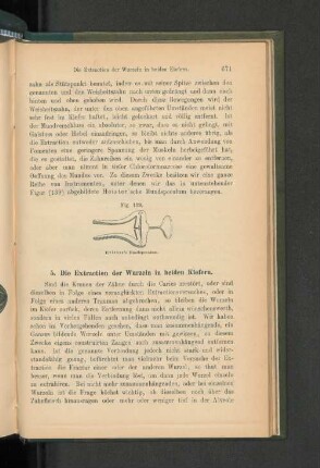 5. Die Extraction der Wurzeln in beiden Kiefern.