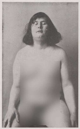 Fotografie eines angeblich homosexuellen Mannes (1)