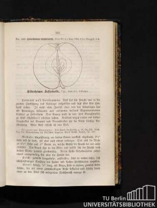 No. 320. Hildesheimer Saftreinette.